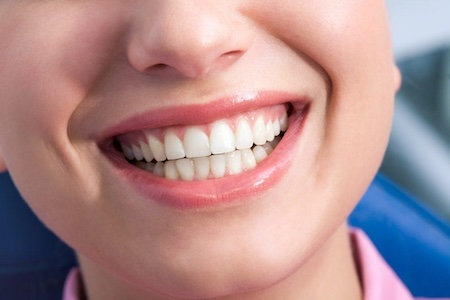 A beautiful girl showing her charismatic smile at the dentist near you in Aliso Viejo, Laguna Niguel and Mission Viejo.
