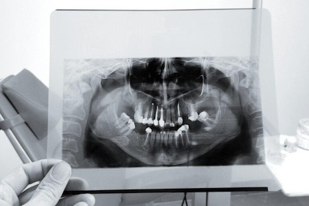 A hygienist viewing a patient’s dental scan.