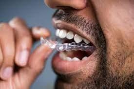 man putting on invisalign