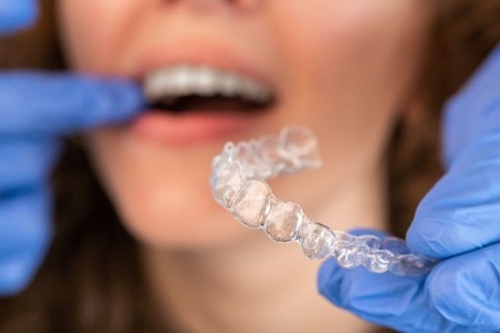 woman receiving invisalign