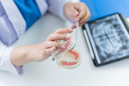 The best endodontist near you in Aliso Viejo shows a plastic dental model.