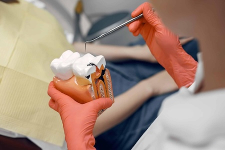 A dentist showing how a root canal is being done with precision at Aliso Creek Dental.