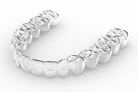 invisalign