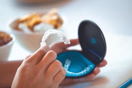 invisalign