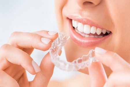 woman holding invisalign