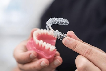 An Invisalign dentist showing how to wear invisible braces.