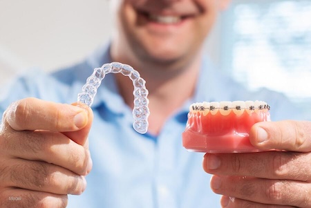A dentist showing Invisalign vs braces difference.