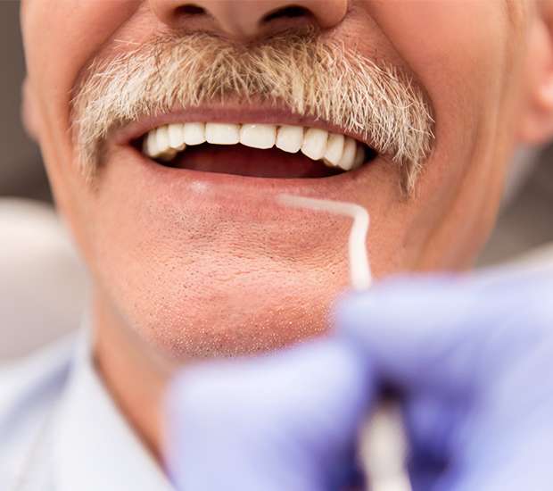 Aliso Viejo Adjusting to New Dentures