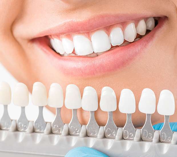 Aliso Viejo Cosmetic Dentist
