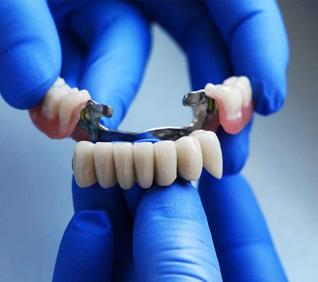 Aliso Viejo Dental Bridges