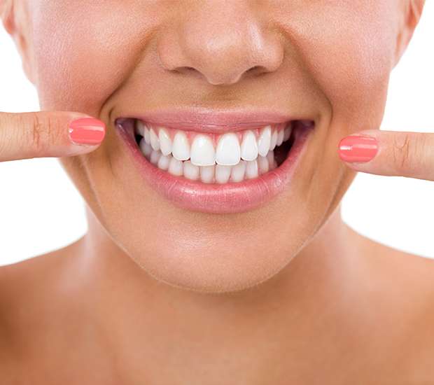 Aliso Viejo What Is Gum Contouring and Reshaping