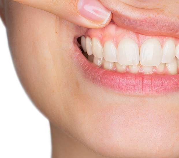 Aliso Viejo Gum Disease