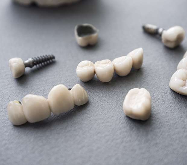 Aliso Viejo The Difference Between Dental Implants and Mini Dental Implants