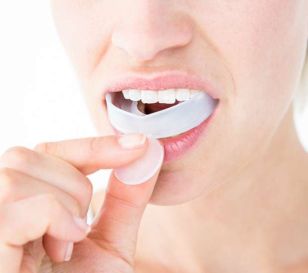 Aliso Viejo Mouth Guards