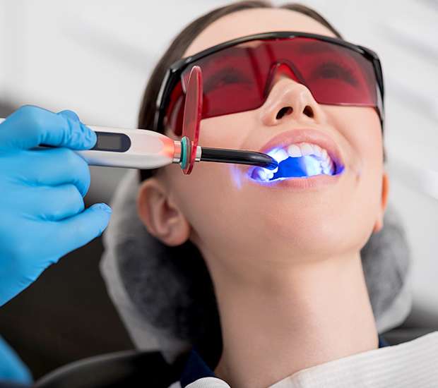 Aliso Viejo Professional Teeth Whitening