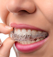 Clear Aligners - Almost Invisible Braces Aliso Viejo, CA