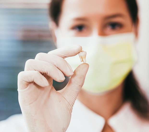 Aliso Viejo Tooth Extraction