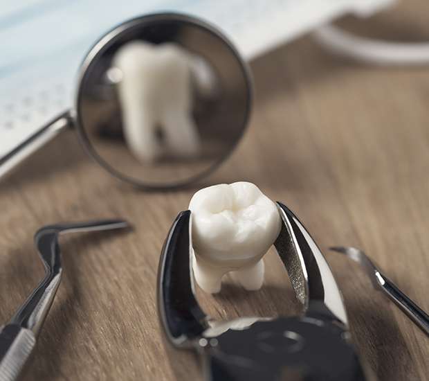 Aliso Viejo When Is a Tooth Extraction Necessary